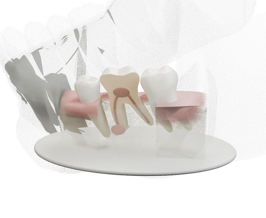 Dent en coupe et canaux